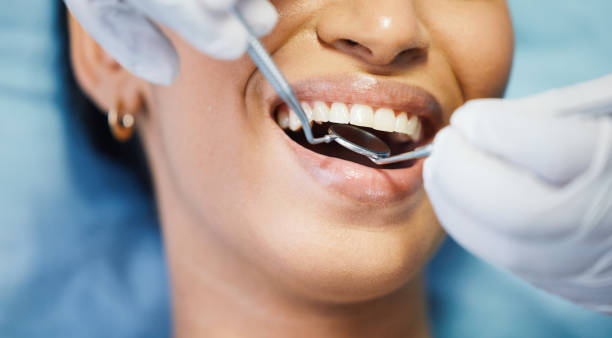 Best 24-Hour Emergency Dental Care in Sidney, IL